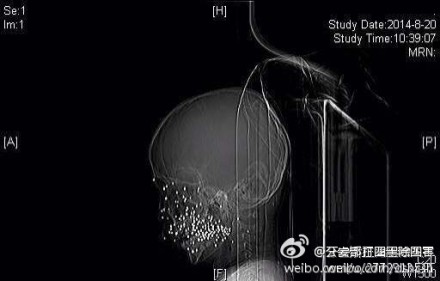 http://www.yisela.cn/uploadfile/2014/0821/20140821042153157.jpg