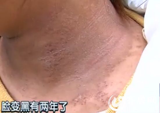 http://www.yisela.cn/uploadfile/2015/0420/20150420032342279.jpg