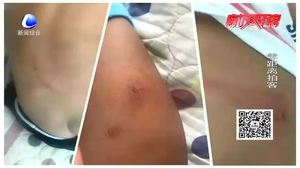 小區(qū)地磚塌陷現暗井 孩子被卡多處擦傷